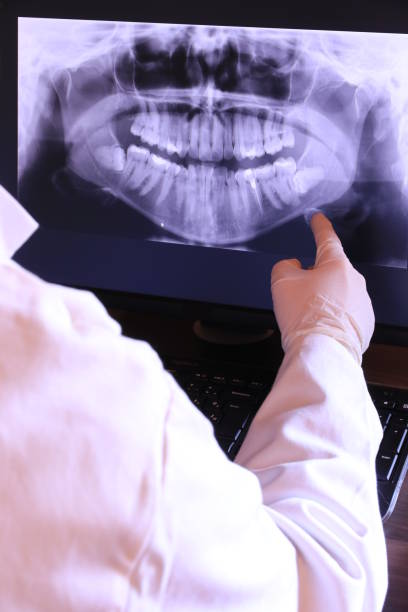 Best Emergency Dental Care for Broken or Chipped Teeth in Plattsburgh West, NY