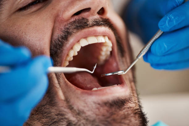 Best Pediatric Emergency Dentist in Plattsburgh West, NY